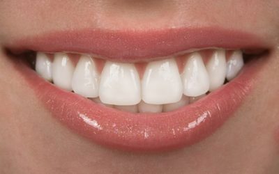 Dobra komunikacija na temu nijansi zuba između stomatologa i zubotehničke laboratorije